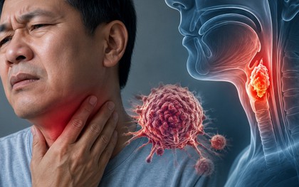 Bác sĩ cảnh báo: 6 DẤU HIỆU bất thường ở cổ họng có thể liên quan đến ung thư, nhiều người nhầm là viêm họng thông thường