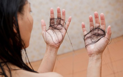 Lời khuyên cho những người hay bị rụng tóc