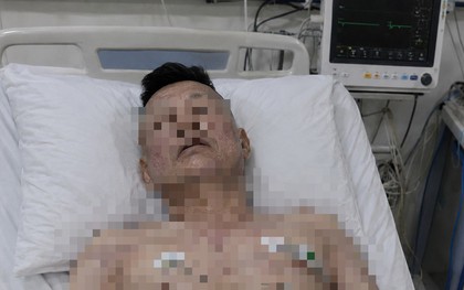 Người đàn ông 46 tuổi tử vong trên giường, bác sĩ cảnh báo loại đồ uống quen thuộc "vạn người mê"