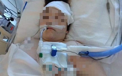 Cô gái 26 tuổi tử vong vì ung thư phổi, từng lên mạng cảnh báo 4 dấu hiệu tuyệt đối không được bỏ qua!