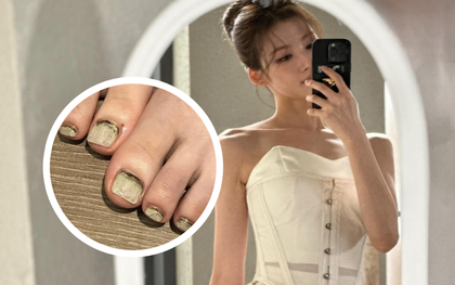 Rợn tóc gáy vì lướt trúng bộ móng chân rong rêu của mỹ nhân top 3 thế giới