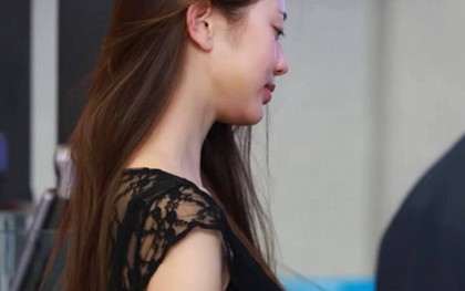 Jang Wonyoung lộ mặt bị thâm tím