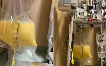 Người phụ nữ 32 tuổi "máu trắng đục như sữa" vì thứ quen thuộc trong tủ thuốc