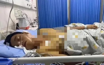 Ung thư gan cướp đi sinh mạng hơn 700.000 người mỗi năm, bác sĩ cảnh báo: Chờ đau thì đã muộn!