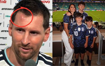 Messi sưng u đầu, được vợ đẹp con ngoan động viên sau chiến thắng nhọc nhằn của Argentina trước Cape Verde