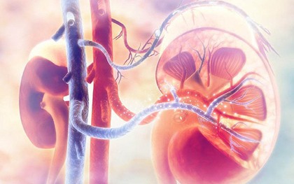 Thói quen của nhiều người Việt khiến thận ứ nước, mỏng như giấy: Bác sĩ cũng phải bất lực