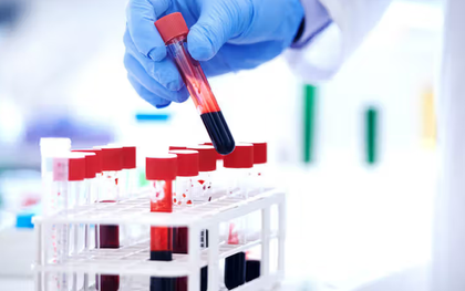 Người phụ nữ 63 tuổi ăn đậu phụ, uống sữa mỗi ngày vẫn thiếu protein: Đây là lý do!