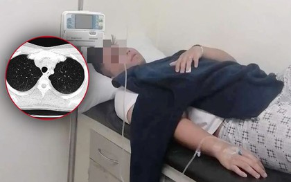 Nam thanh niên tuổi 20 phổi trắng xóa, suy đa tạng: Nguyên nhân xuất phát từ… ruộng lúa