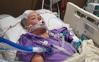 Một VĐV 18 tuổi qua đời đột ngột vì xuất huyết não