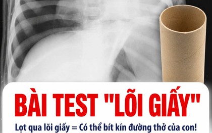 BS chuyên khoa Nhi tiết lộ: Chỉ bằng bài kiểm tra với lõi giấy vệ sinh, cha mẹ có thể ngăn con hóc dị vật