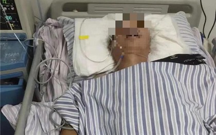 Người đàn ông 51 tuổi đang cười nói bỗng nhồi máu não, bác sĩ nói thẳng: 3 loại gia vị là "sát thủ"