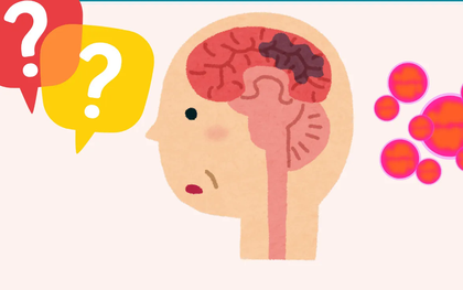 Ai có nguy cơ mắc bệnh do não mô cầu cao hơn?