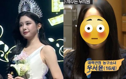 Hoa hậu bị "đào" loạt ảnh quá khứ, dân mạng chỉ trích "dao kéo" quá đà không xứng đăng quang!