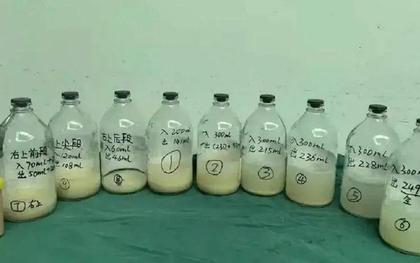 Bé gái 6 tuổi ho suốt 2 tháng, phổi chứa đầy dịch trắng như sữa: Bác sĩ lên tiếng cảnh báo