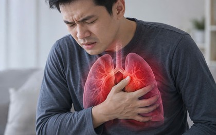 Bác sĩ BV Bạch Mai chỉ: 4 nguy cơ gây ung thư phổi ở người không hút thuốc, nhiều người vô tình tiếp xúc mỗi ngày mà không hay biết