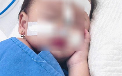 Bé gái 22 tháng tuổi tưởng sốt thông thường, 5 ngày sau rơi vào hôn mê gan, suy đa cơ quan phải lọc máu liên tục