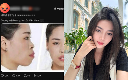 Người đẹp lột xác thành công nhờ "dao kéo" vướng lùm xùm liên quan đến miệt thị ngoại hình người Việt