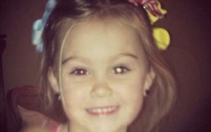 Đôi mắt bé gái 3 tuổi xinh xắn được "cứu sống" vì mẹ đăng ảnh lên Facebook