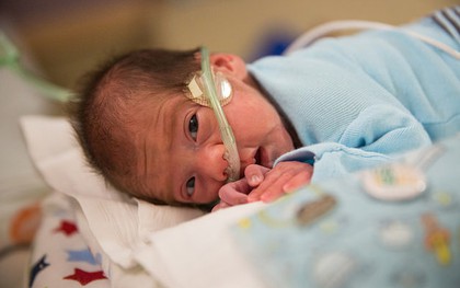 Cậu bé kỳ diệu chào đời 54 ngày sau khi mẹ chết não