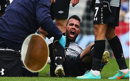 Cận cảnh chấn thương kinh hoàng của tiền vệ Tottenham