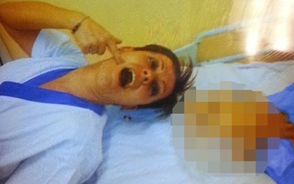 Nữ y tá tạo dáng bên xác chết bệnh nhân gây phẫn nộ