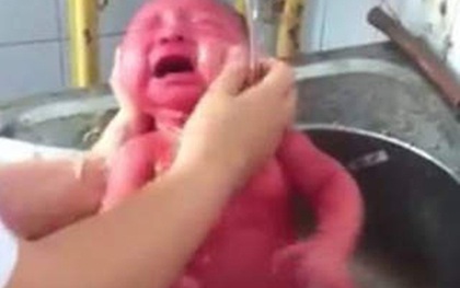 Clip tắm bé sơ sinh gây phẫn nộ: "Niềm vui" lạ của GĐ bệnh viện