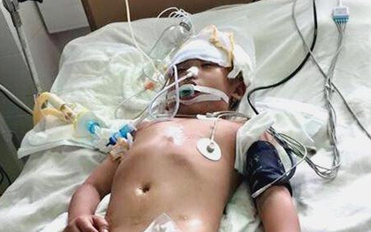 Xót xa cậu bé 8 tuổi bị xe máy tông dập não, hôn mê sâu