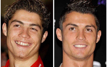 Ronaldo và những thay đổi trên khuôn mặt qua năm tháng