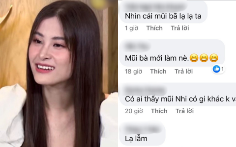 Đông Nhi dính nghi vấn can thiệp dao kéo hậu đám cưới, sống mũi chiếm trọn spotlight vì càng nhìn càng thấy lạ