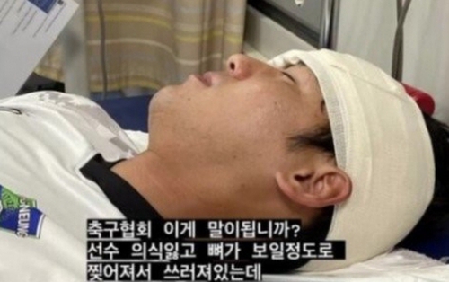 Dùng xe tải chở cầu thủ bị rách trán, lộ xương đi bệnh viện thay vì xe cứu thương, Hiệp hội bóng đá Hàn Quốc bị chỉ trích