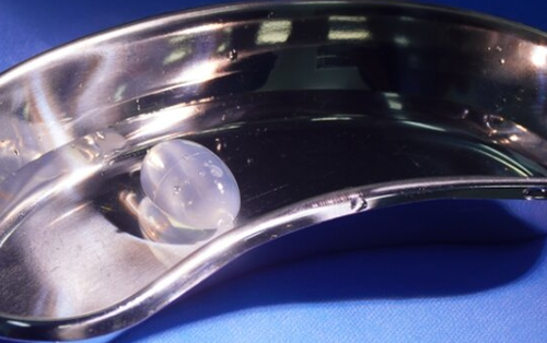 Đặt tinh hoàn nhân tạo cho chàng trai 20 tuổi