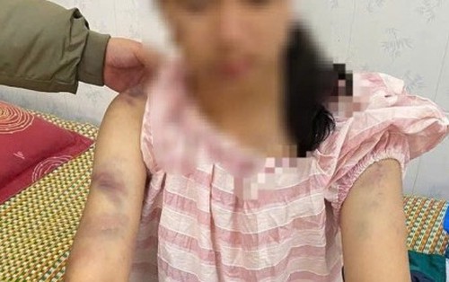 Mẹ bé gái bị bạo hành ở Thái Nguyên: Con bị đánh suốt 4 tiếng, dọa rút móng tay