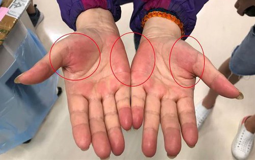 Nếu thường xuyên có 7 cảm giác này, rất có thể nhiều bệnh ung thư đang "thách thức", bạn cần đi khám ngay!