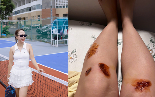 Dân văn phòng đổ xô chơi pickleball: "Đau nhưng tôi vẫn ham"