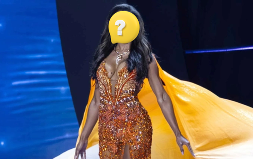 Hoa hậu kiêm bác sĩ nhãn khoa bị gãy xương, xuất huyết nội sọ chỉ sau 1 cú ngã