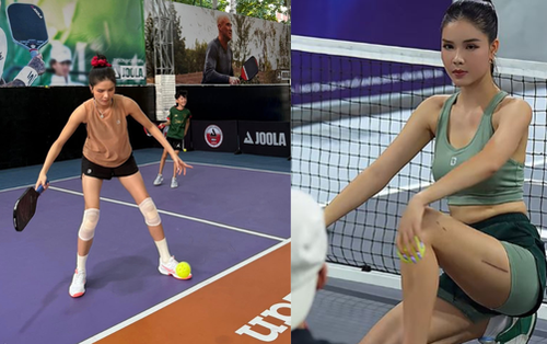 Rõ vết sẹo dài của Kỳ Hân sau tai nạn trên sân pickleball