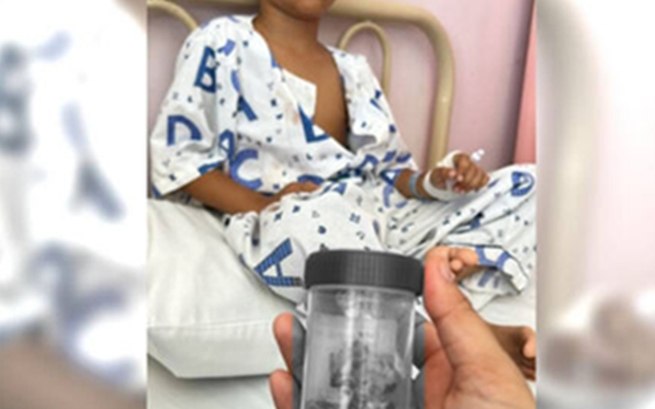 Bé trai 12 tuổi mất 12 chiếc răng 1 lúc vì thói quen nhiều trẻ mắc phải