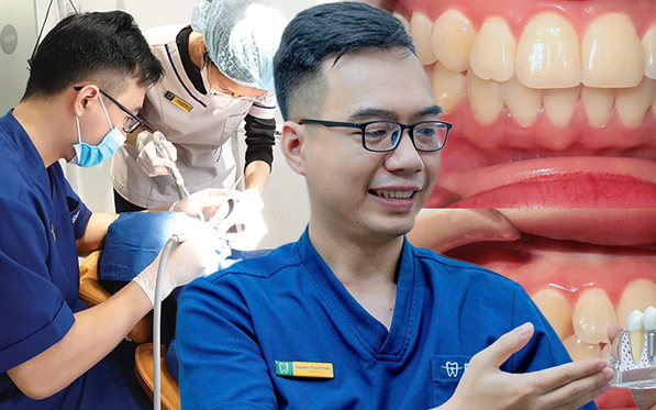 Niềng răng sau tuổi 30: Bác sĩ nói trễ nhưng không hề muộn để đẹp và khỏe