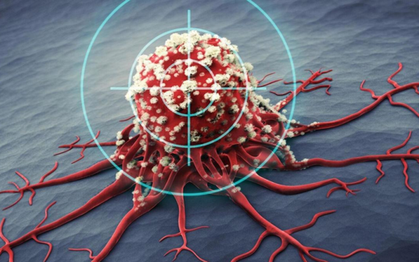 Một năm trước khi ung thư phát triển, cơ thể sẽ phát ra 5 dấu hiệu cảnh báo, nhưng 90% người lại bỏ qua