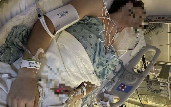 Chàng trai 26 tuổi phải cắt bỏ hơn 10cm "cậu nhỏ" vì bỏ qua 1 thứ ai cũng tưởng tắm... chưa kỹ