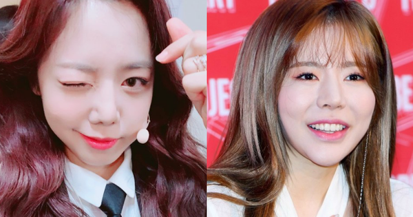 Thảm họa thẩm mỹ mới của Kpop nhận “gạch” vì khoe ảnh mặt biến chứng giống như… Sunny (SNSD)?