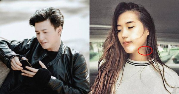 Tình mới Huỳnh Anh liên tục bị soi vết bầm khó hiểu trên cổ