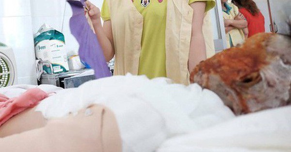 Mẹ chồng tạt axit mù 2 mắt con dâu: Nghi can đột ngột tử vong