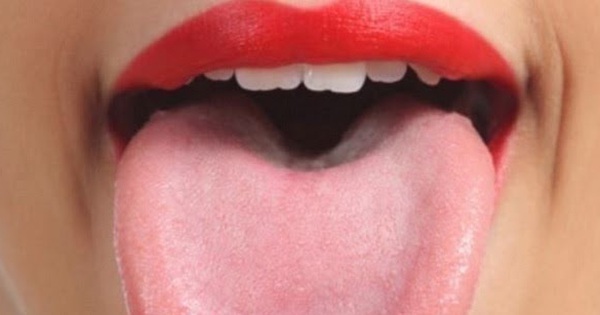 Nếu lưỡi bạn có những biểu hiện sau, đừng chủ quan, có thể bạn đang có một số vấn đề về sức khỏe!