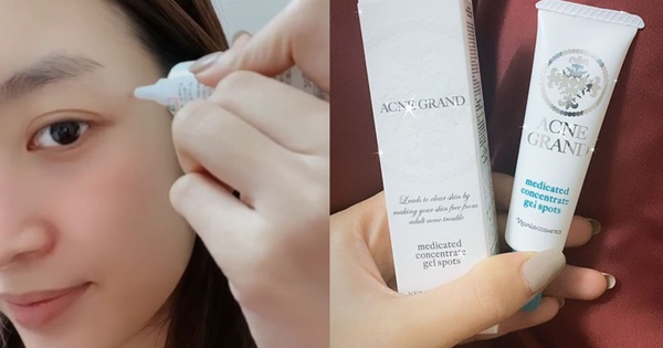 Nghỉ ở nhà da bỗng nổi đóa, Đỗ Mỹ Linh gợi ý lọ gel chấm mụn thần thánh, mụn to đến mấy cũng ''xử'' được tuốt