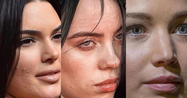 
                                    Hung thần ảnh cận mặt tố visual thật dàn sao: Làn da nhăn của Kim Kardashian chưa gây hoảng bằng cô em Kendall Jenner!