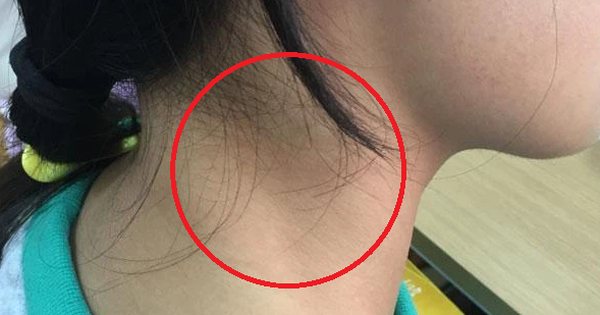 3 bộ phận trên cơ thể tốt nhất không nên để người khác chạm vào, nếu không sẽ chuốc họa vào thân - Vimarsana News