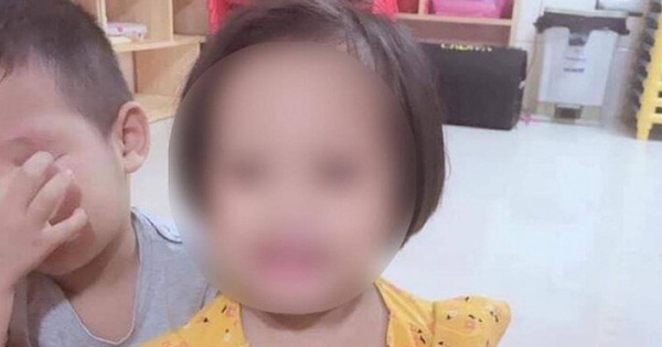 
                                    Tin buồn: Bé gái 3 tuổi bị nhân tình của mẹ đóng đinh vào đầu đã tử vong