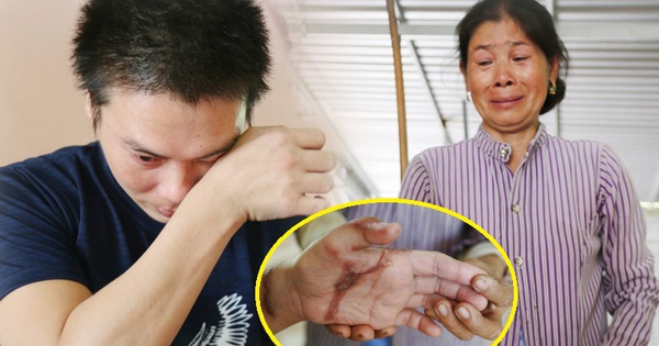 Boyfriend leaves after 6 years of love, young man cries until he sees the veins in his arms and legs cut off without money to reconnect