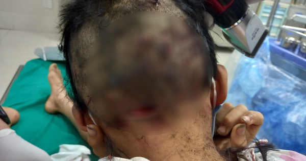 The boy was bitten by a dog, the wound was entangled